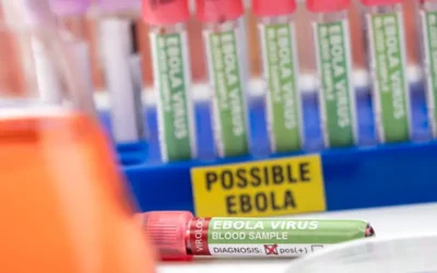 Some Facts about Ebola Virus – Symptoms, Diagnosis and Treatment