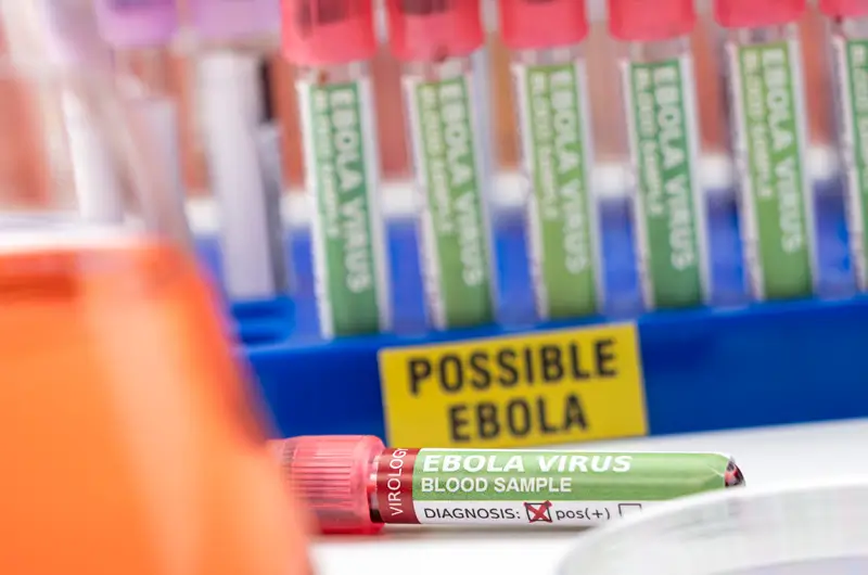 Some Facts about Ebola Virus – Symptoms, Diagnosis and Treatment