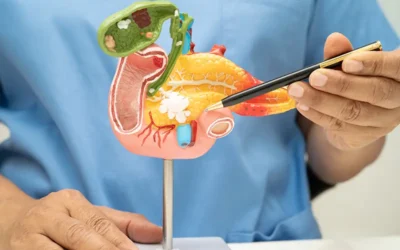 Oncologists Must Help Curb Deadliness of Pancreatic Cancer