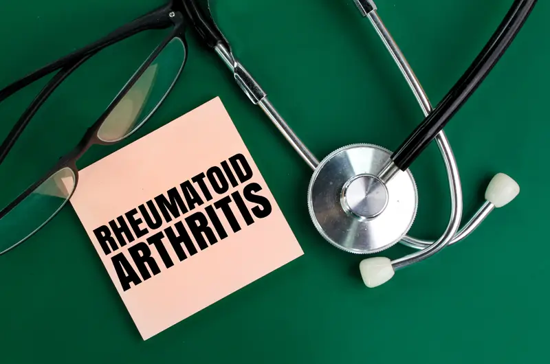 Rheumatoid Arthritis Diagnosis and Coding - Importance