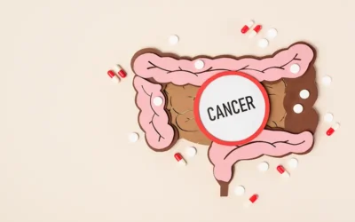 Routine Screening for Colorectal Cancer to Facilitate Early Diagnosis and Treatment