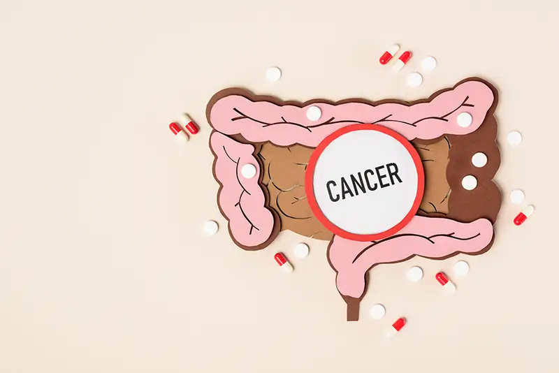 Routine Screening for Colorectal Cancer to Facilitate Early Diagnosis and Treatment