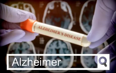 Alzheimer’s Disease – Routine Tests Facilitate Early Diagnosis and Treatment