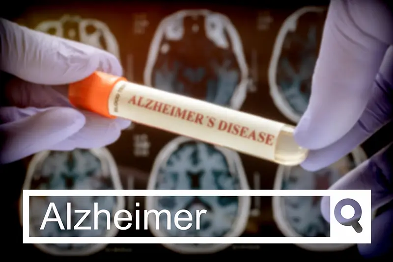 Alzheimer’s Disease Alzheimer's Disease - Routine Tests Facilitate Early Diagnosis and Treatment