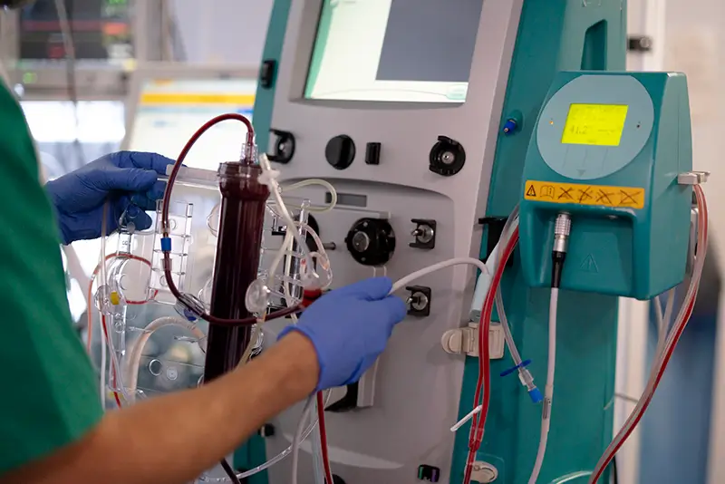 Rising Dialysis Costs Solutions to Mitigate Rising Dialysis Costs