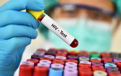 Medical Coding for HIV Screening and Diagnosis