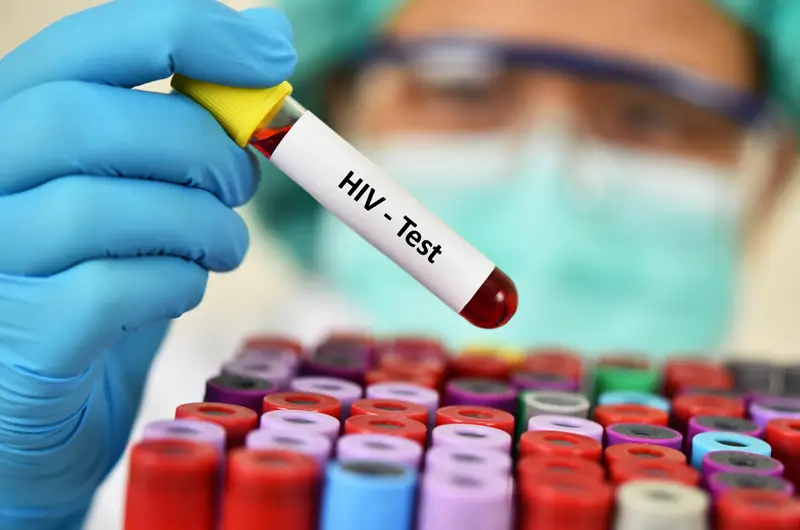 Medical Coding for HIV Screening Medical Coding for HIV Screening and Diagnosis