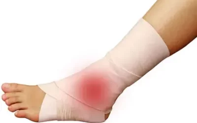 ICD-10 Coding for Sprains and Strains