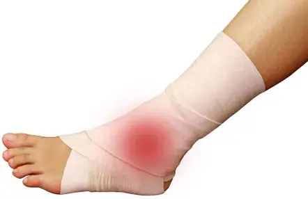ICD-10 Coding for Sprains and Strains