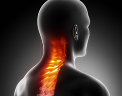 ICD-10 Coding for Cervical Disc Disorders and Displacements