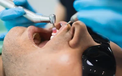 Importance of Comprehensive Insurance Verification for Periodontal Care