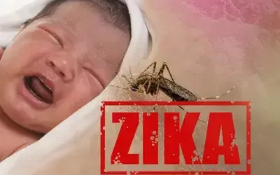 ICD-10 Code for Zika Virus