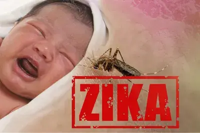 ICD-10 Code for Zika Virus