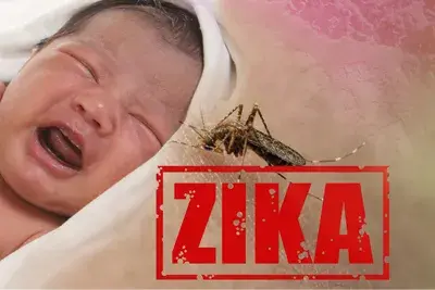 Zika Virus