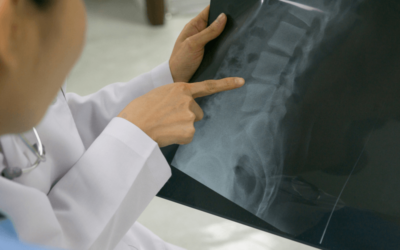 What are the Spinal Subluxation Codes for Chiropractic Care of the Cervical, Thoracic and Lumbar Region