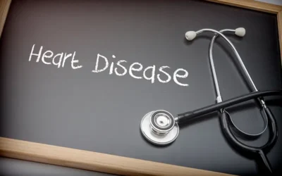 How to Code for Hypertensive Heart Disease