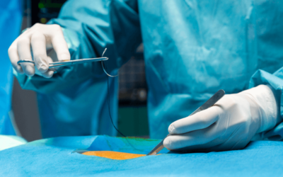 ICD-10 Surgery Codes – Essentials for Appropriate Reimbursement