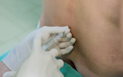 New Epidural Injection Codes to Improve Pain Management Reimbursement in 2017