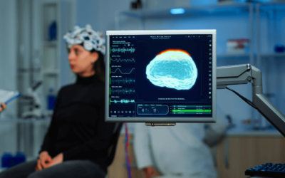 Learn the Nuances of Medical Billing and Coding for Stroke