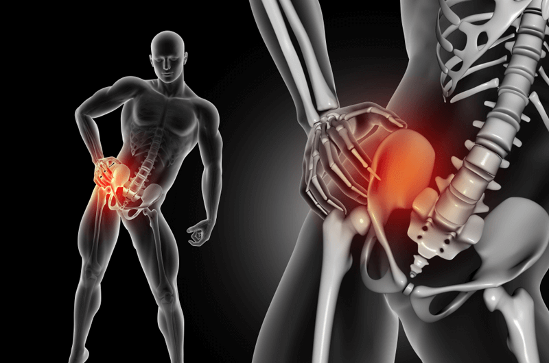 2017 CPT Code Changes for Pelvic Fracture – Focus on Complexity of Treatment