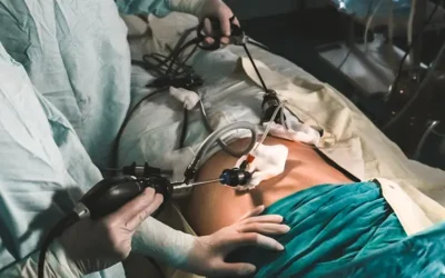 Challenges of Coding Traditional and Laparoscopic Colorectal Surgery