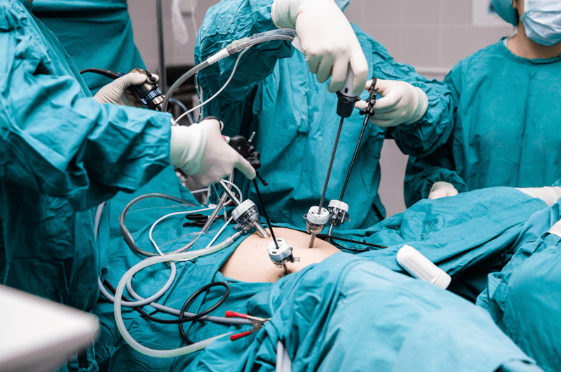 Challenges of Coding Traditional and Laparoscopic Colorectal Surgery