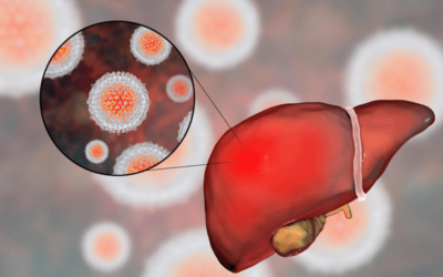 Stay Up-to-date with ICD-10 Diagnostic Codes for Hepatitis