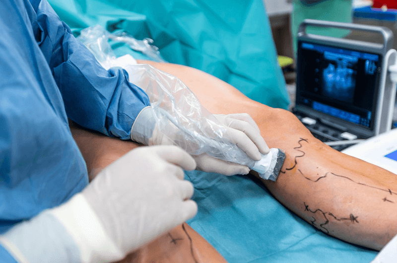 2017 Coding and Reimbursement Guidelines for Vascular Surgeons