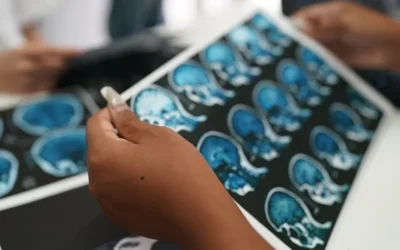 Encephalopathy – ICD 10 Coding and Documentation Guidelines