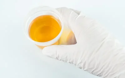 Ensuring Billing Compliance for Urine Drug Testing