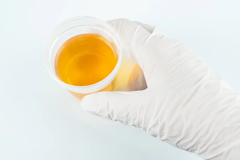 Billing Compliance for Urine Drug Testing Ensuring Billing Compliance for Urine Drug Testing