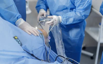 Learn the Essentials of Knee Arthroscopy Coding