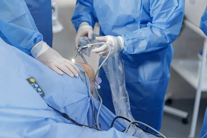 Learn the Essentials of Knee Arthroscopy Coding