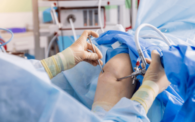 Learn the Essentials of Knee Arthroscopy Coding