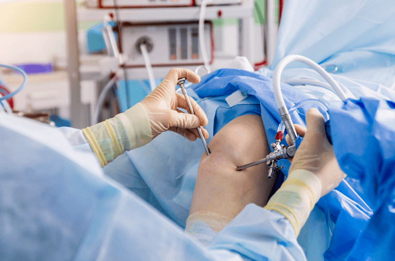 Learn the Essentials of Knee Arthroscopy Coding