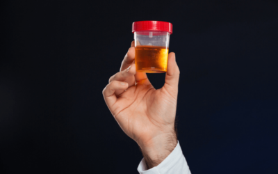 Ensuring Billing Compliance for Urine Drug Testing