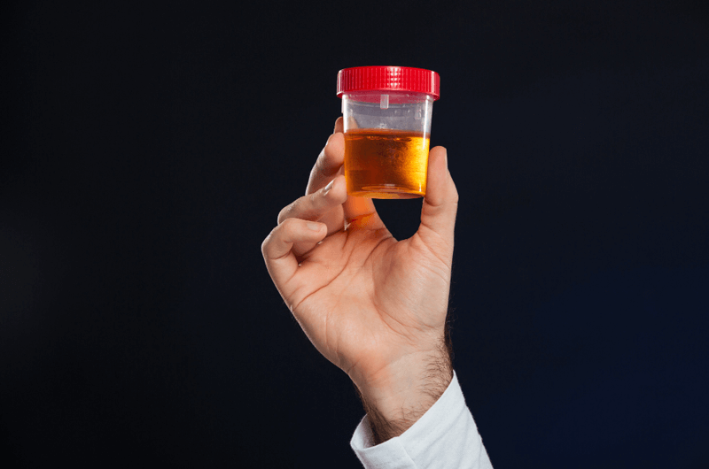 Ensuring Billing Compliance for Urine Drug Testing