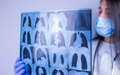 How to Code for COPD (Chronic Obstructive Pulmonary Disease)