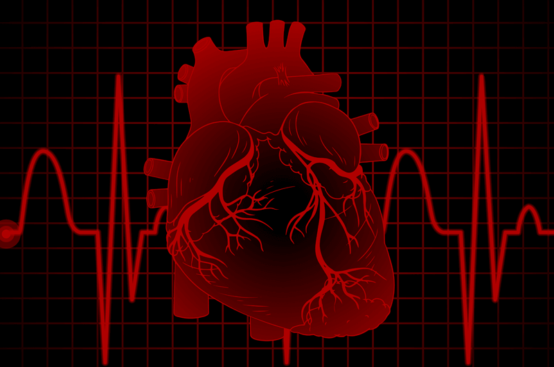 2018 ICD-10 Code Updates and Documentation Guidelines for Myocardial Infarction (MI)