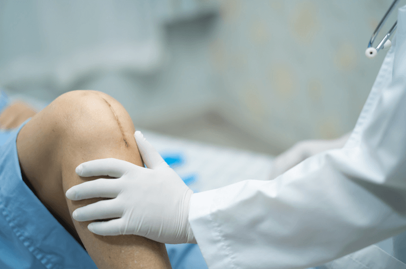 Accurate Reporting of Orthopedic Implant Removal