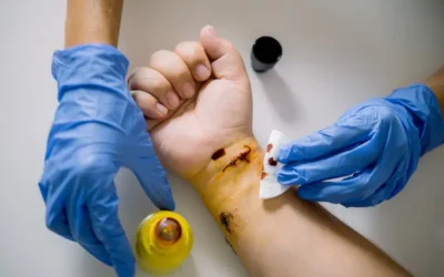 Procedural Coding for Wound Care Management – Medicare and PMR Billing Guidelines