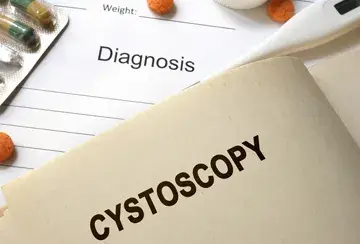 Cystoscopy