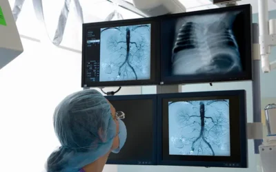 How to Use CPT Codes for Angiography Procedure