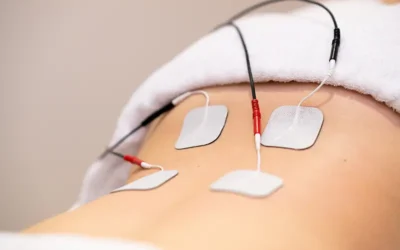 Procedure Codes and Guidelines for Reporting Spinal Cord Stimulation