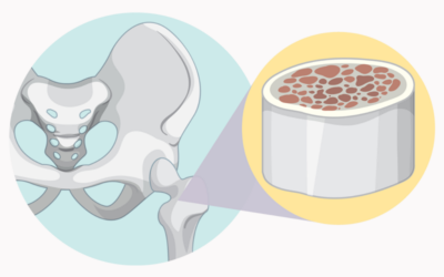 Understand 2018 Updates to Bone Marrow Procedure Codes