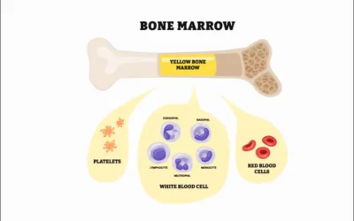 Understand 2018 Updates to Bone Marrow Procedure Codes