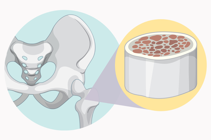 Understand 2018 Updates to Bone Marrow Procedure Codes