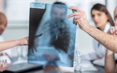 Diagnosing and Documenting Pneumonitis – An Overview