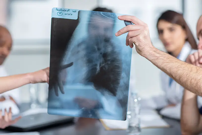 Diagnosing and Documenting Pneumonitis Diagnosing and Documenting Pneumonitis - An Overview
