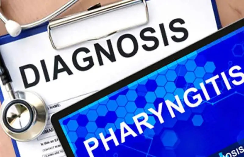 icd 10 code for pharyngitis due to infectious mononucleosis
